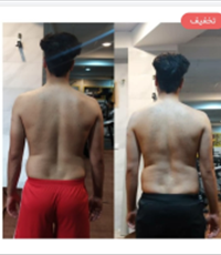 حرکات-اصلاحی