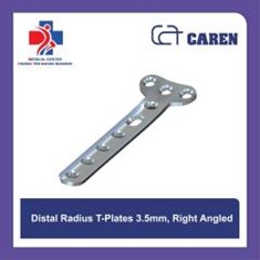 پلاک-تی-دیستال-رادیوس-قطر-3-5