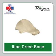 الوگرافت-استخوان-ایلیاک