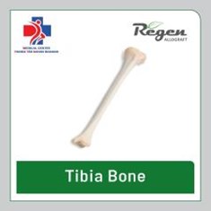 الوگرفت-شفت-تیبیا