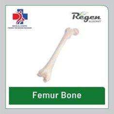 الو-گرفت-فمور