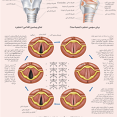 صدا-در-حنجره