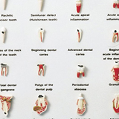 بیماری-های-دندان
