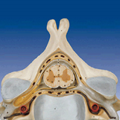 پنجمین-مهره-گردن