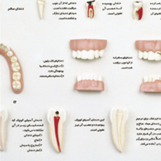 مدل-دندان