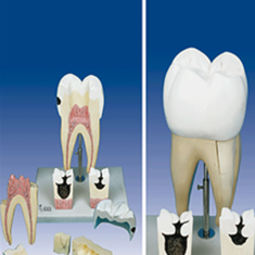 مدل-اولین-دندان-آسیای-بزرگ-فک-تحتانی