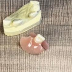 پروتز-دندان-فلیپر-دندانسازی-لبخند-بندرعباس