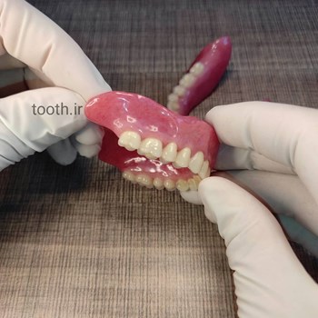 پروتز-های-دندانی-دندانسازی-لبخند-بندرعباس