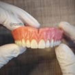 نمونه-پروتز-دندانیدندان-مصنوعیدنداسازی-لبخند-بندرعباس