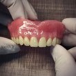 پروتز-های-دندانیدندان-مصنوعیدندانسازی-لبخند-بندر-عباس