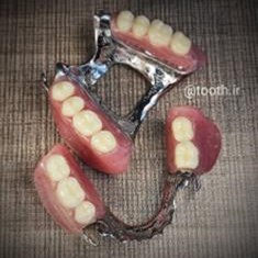 پروتز-پارسیل-متحرک-دندانسازی-لبخند-بندرعباس