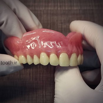 پروتز-های-دندانیدندان-مصنوعیدندانسازی-لبخند-بندر-عباس