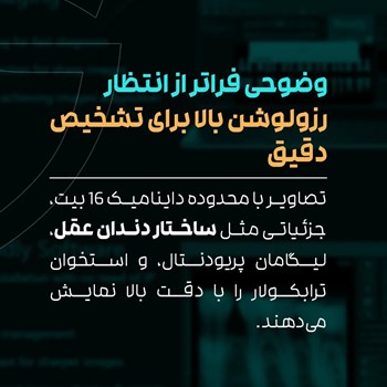 آر-وی-جی-Ray-Sensor