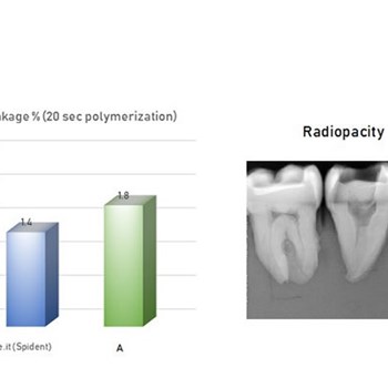 دایکال-نوریبیس-و-لاینراسپیدنت