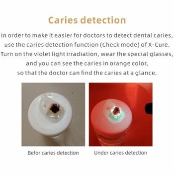 لایت-کیور-پرتوان-وودپیکر-Woodpecker-مدل-Cure